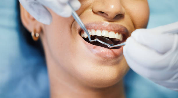 Best Dental Abscess Treatment in New Burlington, OH